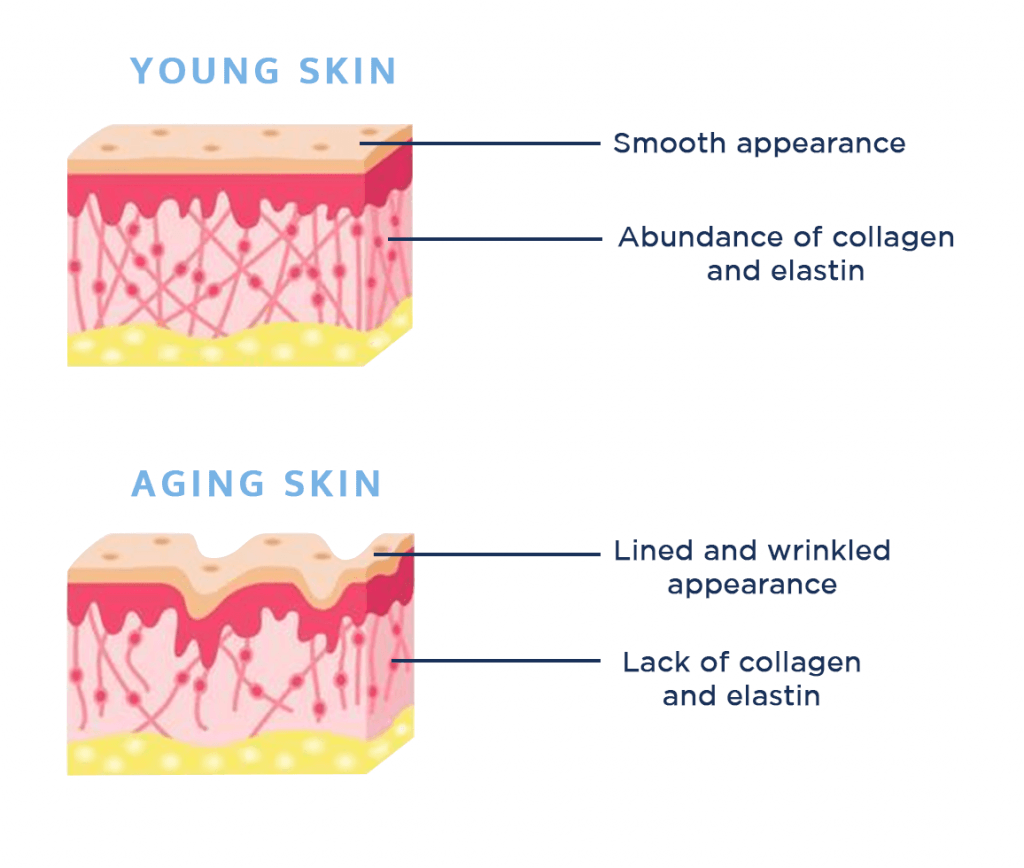 Elasticizing - Rilastil